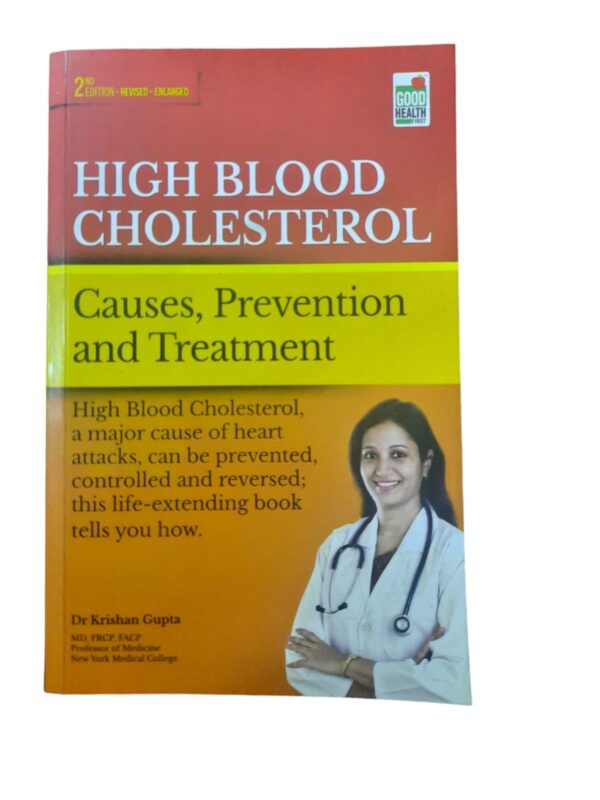 High blood cholesterol causes prevention and treatment