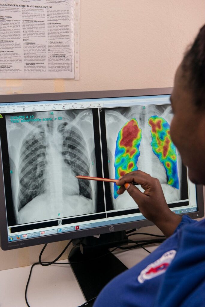 Alt text: "Healthcare worker reviewing AI-analysed chest X-ray with CAD4TB abnormality heatmap